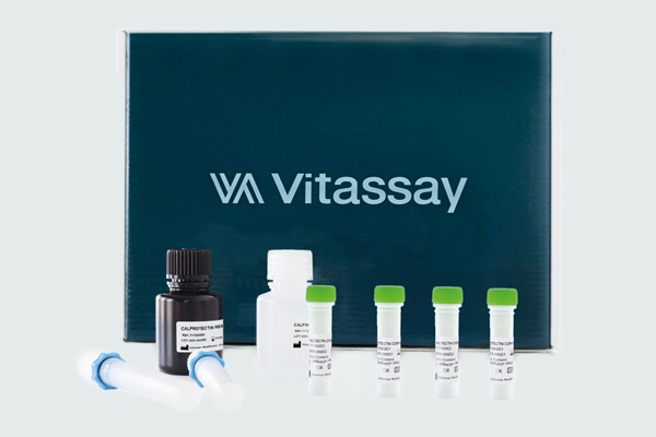 7115001 FOB-TURBIDIMETRIC ASSAY- 100 TEST VITASSAY - Imagen 1
