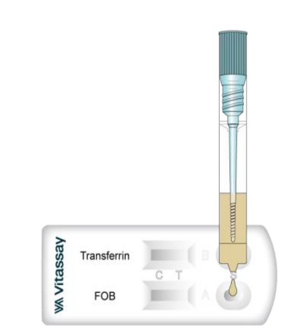 7455003 FOB+TRANSFERRINA DOBLE. 25 TEST. VITASSAY - Imagen 1