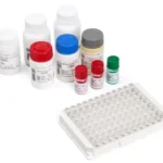 M. PNEUMONIAE IgM Kit