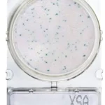 STAPHYLOCOCCUS AUREUS 1 PLACA. COMPACT DRY