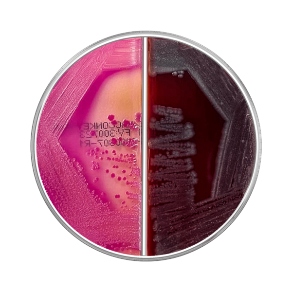 J32 SANGRE 5%/MACKONKEY BIPLACA 10 PLACAS.HARDY DIAGNOSTIC - Imagen 1